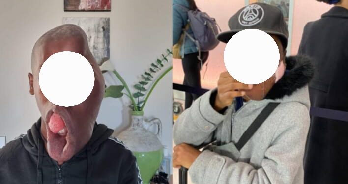 L’émouvant retour en Guinée d’un enfant sauvé par une ONG